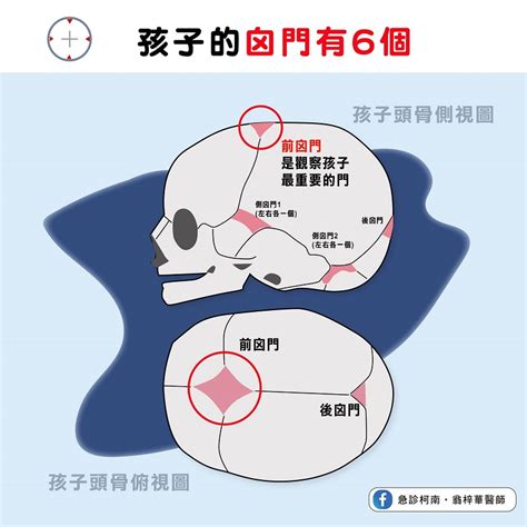 嬰兒額頭凹|囟門可不可以摸？嬰兒囟門4種異常狀況，嚴重恐影響寶寶腦部發。